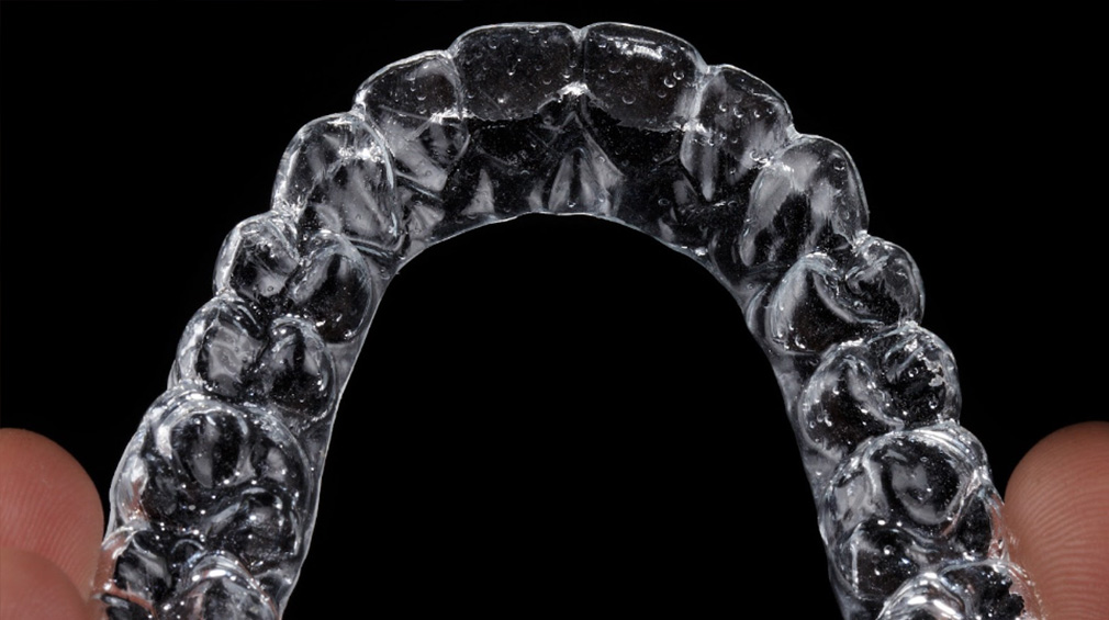 Invisalign-trattamento-come-si-fa.jpg